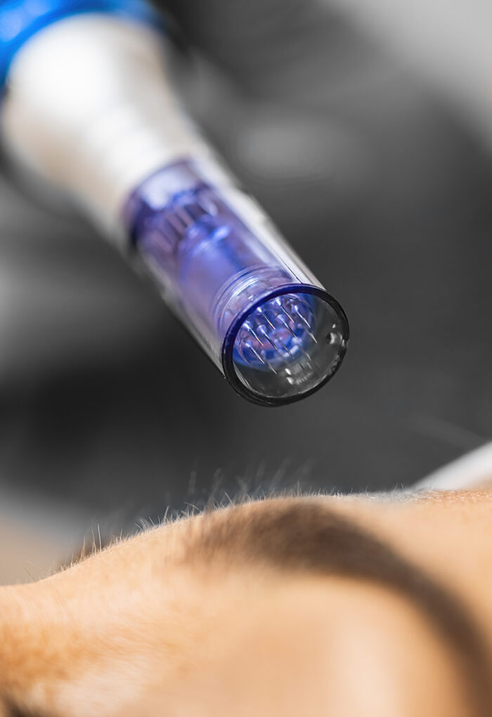 Tratamientos faciales