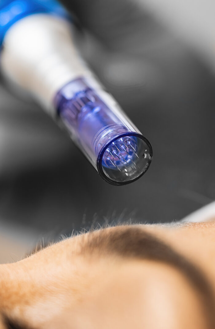 Tratamientos faciales