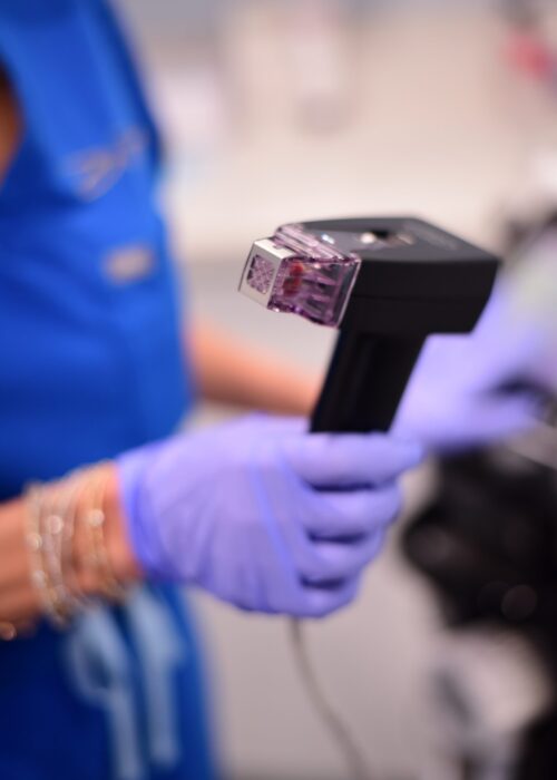 Morpheus8,Treatment,Machine,Tip,Face