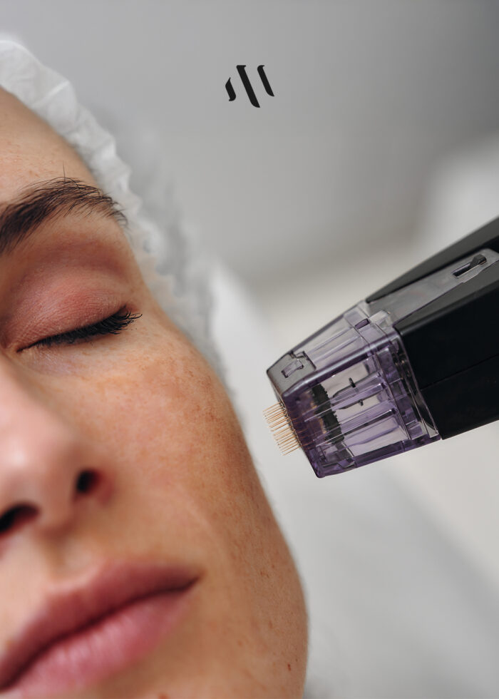 Skin treatments