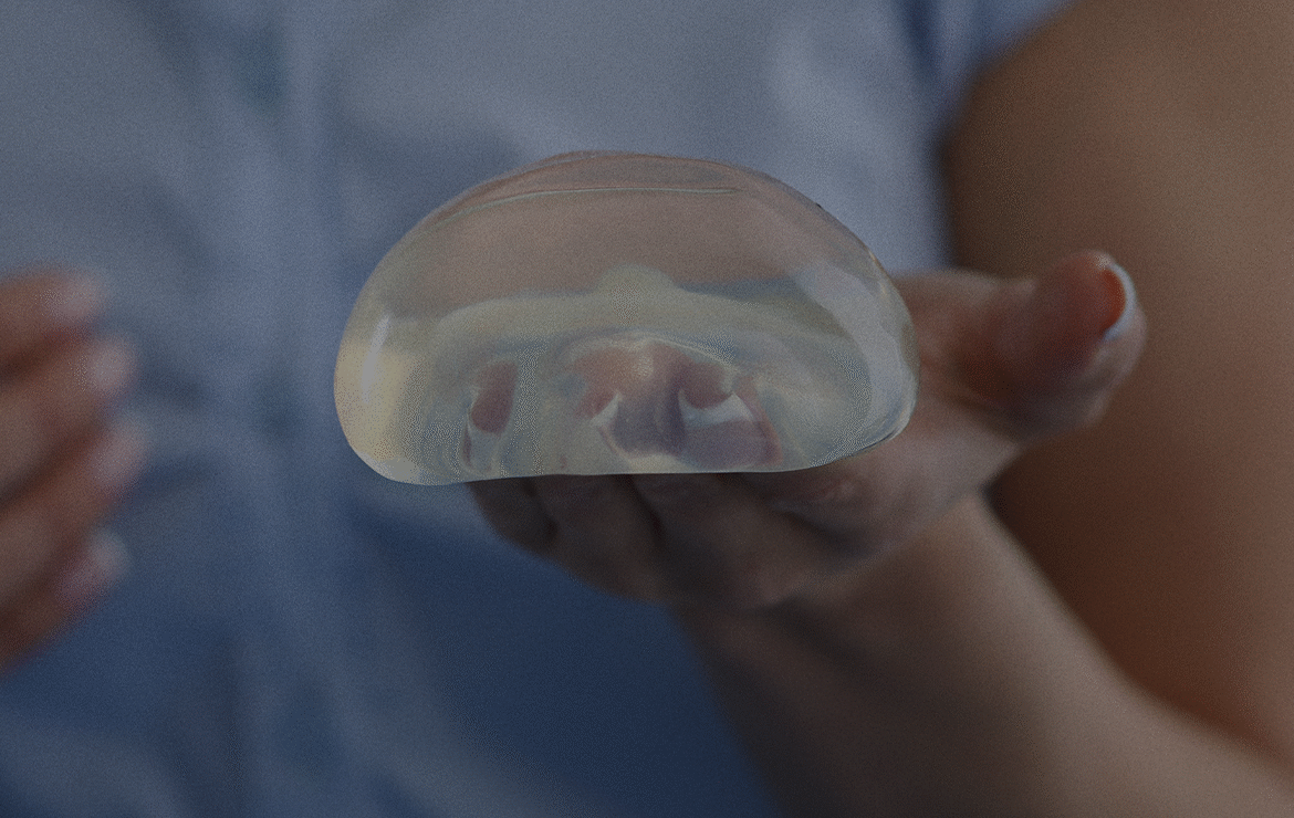 Breast Augmentation Surgery: everything you need to know