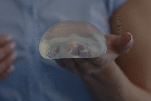 Breast Augmentation Surgery: everything you need to know