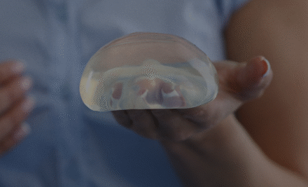 Cirugía de Aumento de Senos: todo lo que debes saber