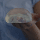 Breast Augmentation Surgery: everything you need to know
