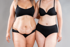 ¿Cuál es el mejor Mommy Makeover?: Una cirugía personalizada