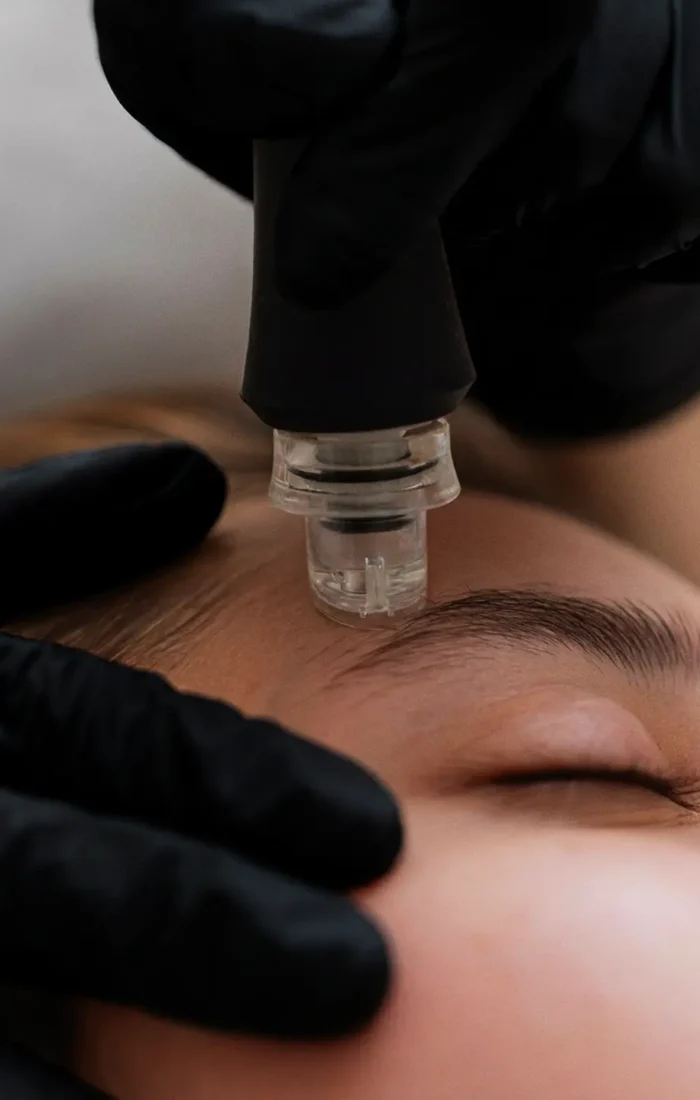 Rejuvenecimiento facial