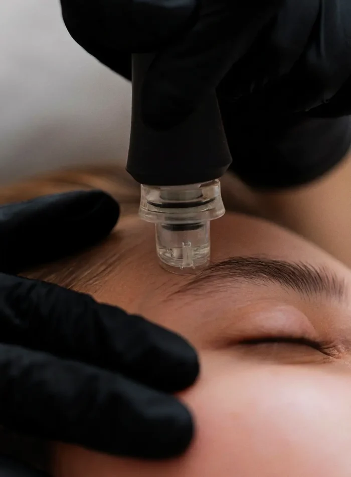 Rejuvenecimiento facial